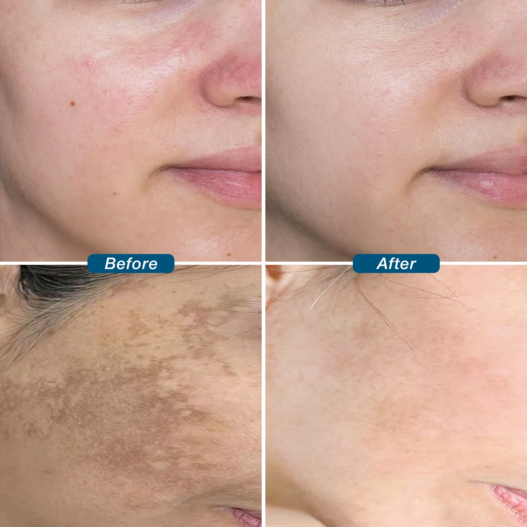 Bright Essence Face Serum