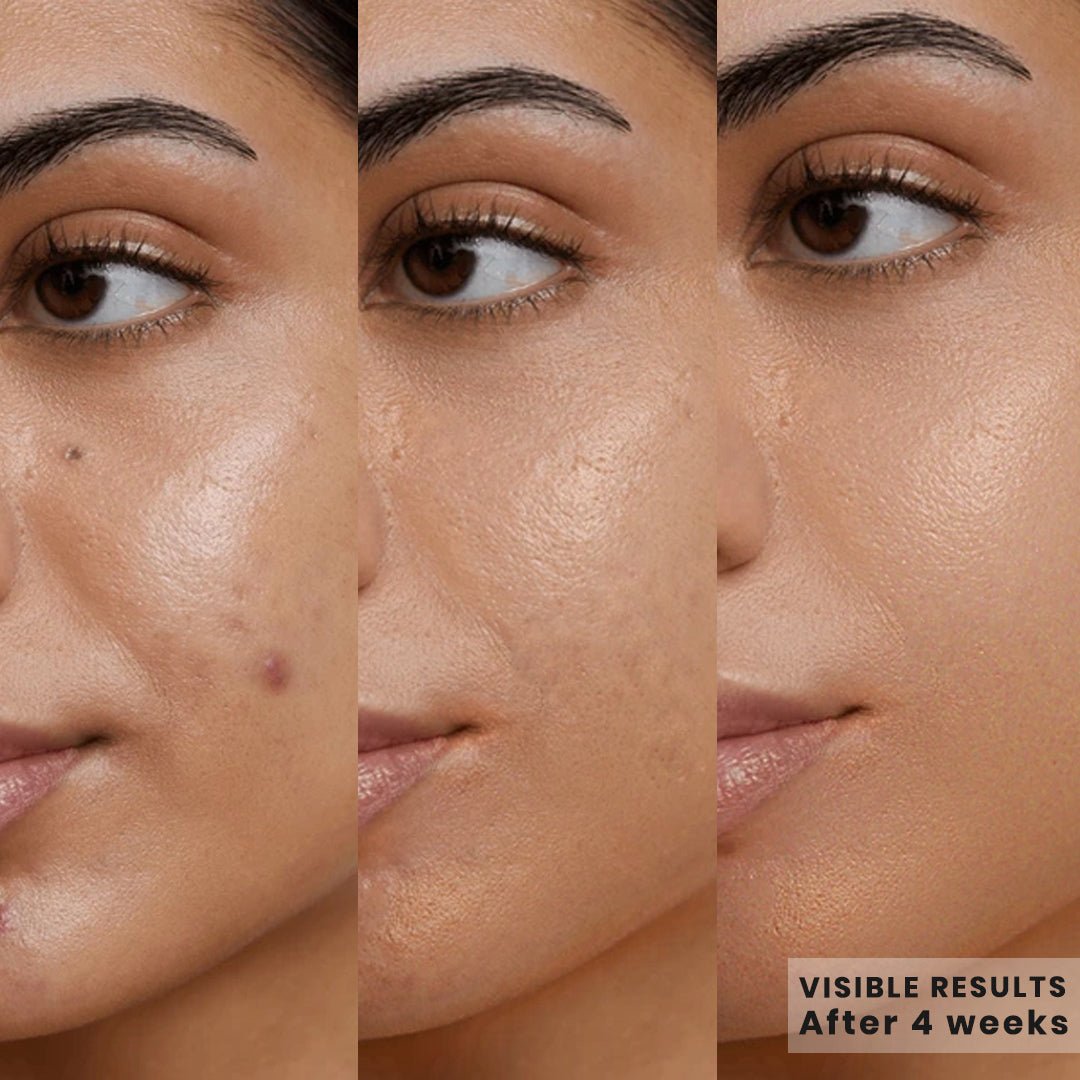 Kojic Acid Face Wash+5% Vitamin C Serum Glow Kit - CLARICA - 