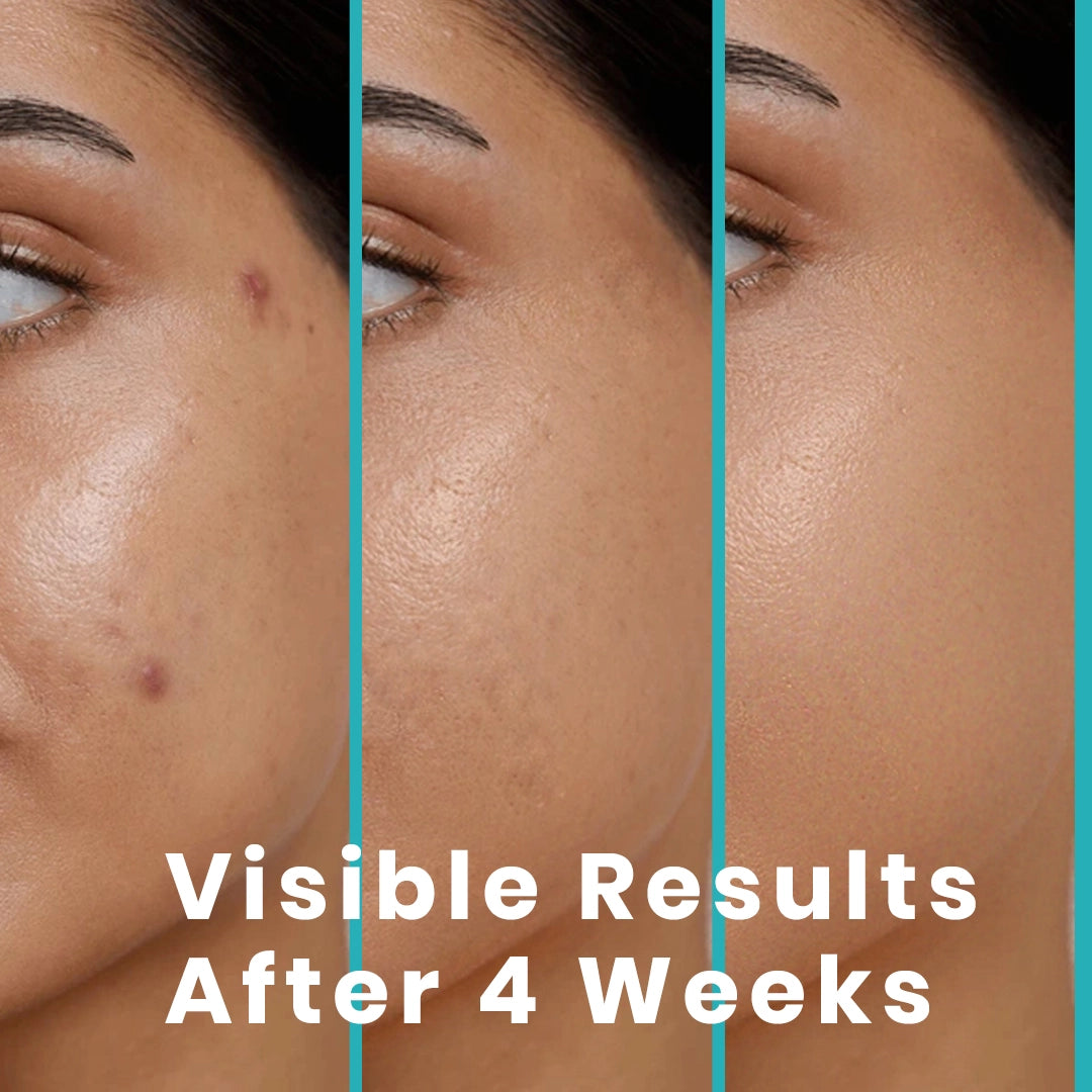 Kojic Acid Brightening Face Wash - Fade Dark Spots & Pigmentation Fast | Clinically tested blend of Kojic Acid, Niacinamide & Lactic Acid for visibly brighter skin in just 2 weeks. |Gentle, non-drying, and safe for all skin types. Dermat-tested.